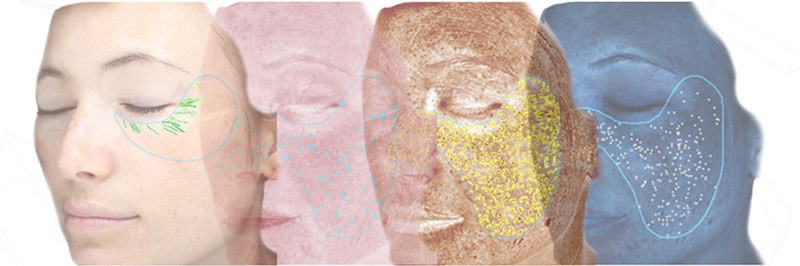 VISIA 皮膚檢測除了可模疑個別老化狀況，顯示皺紋和色斑的精確位置，同時精準顯示皺紋的深度及長短、斑點顏色形狀、大小深淺，並可摸擬5年後老化樣貌。