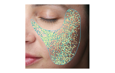 Visia 高階數位膚質檢測儀特色：局部皮膚分析