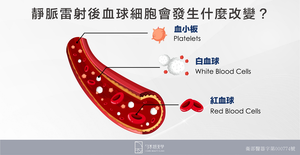 靜脈雷射後血球細胞會發生什麼改變？
